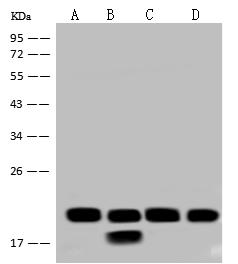 NDUFB7 / B18 Antibody - Anti-NDUFB7 rabbit polyclonal antibody at 1:500 dilution. Lane A: PC3 Whole Cell Lysate. Lane B: HL60 Whole Cell Lysate. Lane C: A431 Whole Cell Lysate. Lane D: K562 Whole Cell Lysate. Lysates/proteins at 30 ug per lane. Secondary: Goat Anti-Rabbit IgG (H+L)/HRP at 1/10000 dilution. Developed using the ECL technique. Performed under reducing conditions. Predicted band size: 16 kDa. Observed band size: 19 kDa.