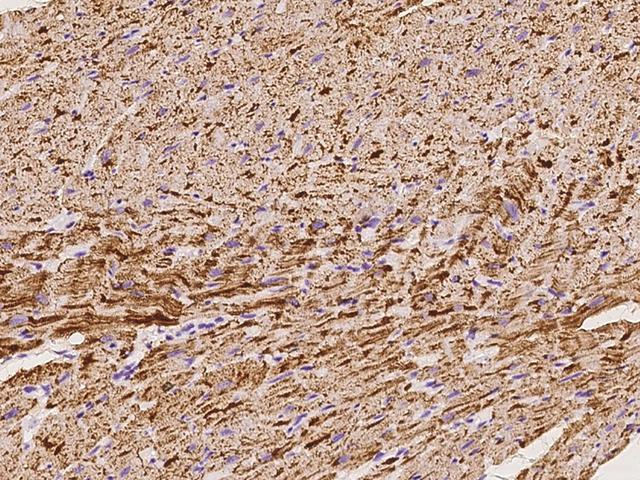 NDUFB7 / B18 Antibody - Immunochemical staining of human NDUFB7 in cynomolgus heart with rabbit polyclonal antibody at 1:100 dilution, formalin-fixed paraffin embedded sections.