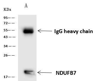 NDUFB7 / B18 Antibody - NDUFB7 was immunoprecipitated using: Lane A: 0.5 mg HL60 Whole Cell Lysate. 4 uL anti-NDUFB7 rabbit polyclonal antibody and 60 ug of Immunomagnetic beads Protein A/G. Primary antibody: Anti-NDUFB7 rabbit polyclonal antibody, at 1:100 dilution. Secondary antibody: Goat Anti-Rabbit IgG (H+L)/HRP at 1/10000 dilution. Developed using the ECL technique. Performed under reducing conditions. Predicted band size: 16 kDa. Observed band size: 20 kDa.