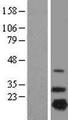 NDUFB7 / B18 Protein - Western validation with an anti-DDK antibody * L: Control HEK293 lysate R: Over-expression lysate