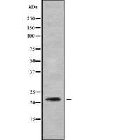 NDUFB8 Antibody - Western blot analysis NDUFB8 using HuvEc whole cells lysates