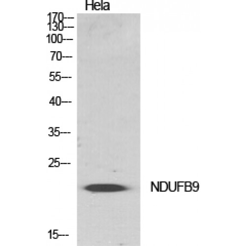 NDUFB9 Antibody - Western blot of NDUFB9 antibody