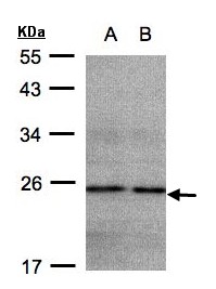 NDUFB9 Antibody - Sample (30 ug whole cell lysate). A: HeLa S3, B: Hep G2 . 12% SDS PAGE. NDUFB9 antibody diluted at 1:500