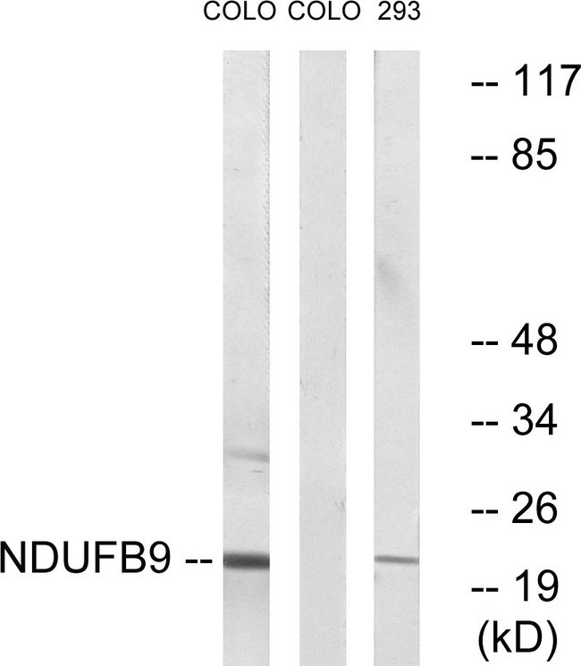 NDUFB9 Antibody - Western blot analysis of lysates from COLO205 cells and 293 cells, using NDUFB9 Antibody. The lane on the right is blocked with the synthesized peptide.