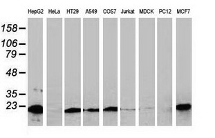 NDUFB9 Antibody - Western blot of extracts (35 ug) from 9 different cell lines by using anti-NDUFB9 monoclonal antibody.