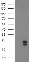 NDUFB9 Antibody - HEK293T cells were transfected with the pCMV6-ENTRY control. (Left lane) or pCMV6-ENTRY NDUFB9. (Right lane) cDNA for 48 hrs and lysed