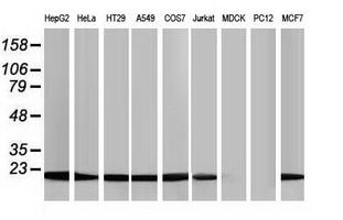 NDUFB9 Antibody - Western blot analysis of extracts. (35ug) from 9 different cell lines by using anti-NDUFB9 monoclonal antibody.