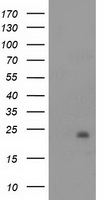 NDUFB9 Antibody - HEK293T cells were transfected with the pCMV6-ENTRY control. (Left lane) or pCMV6-ENTRY NDUFB9. (Right lane) cDNA for 48 hrs and lysed