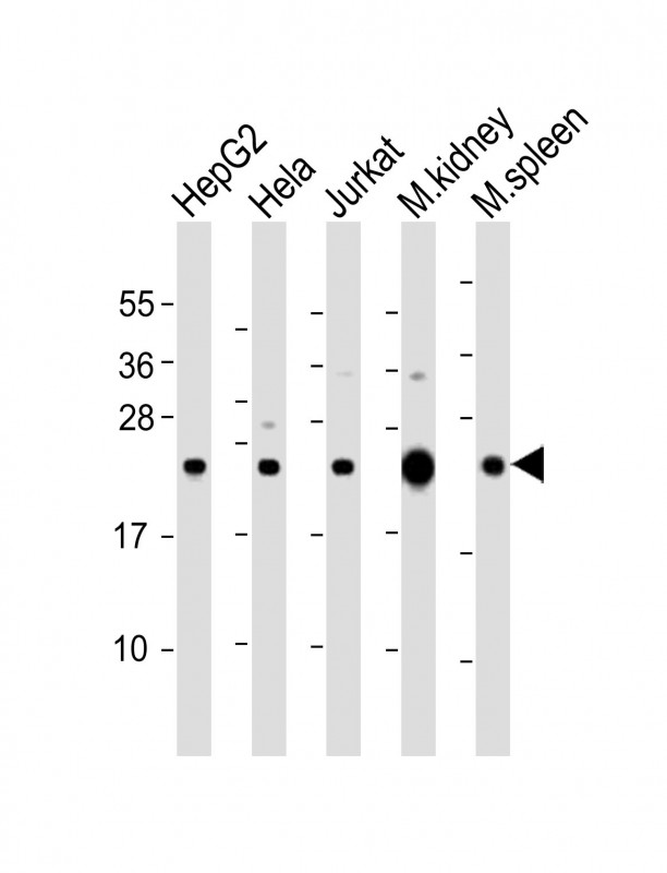 NDUFB9 Antibody - All lanes: Anti-NDUFB9 Antibody (Center) at 1:2000 dilution. Lane 1: HepG2 whole cell lysate. Lane 2: HeLa whole cell lysate. Lane 3: Jurkat whole cell lysate. Lane 4: mouse kidney lysate. Lane 5: mouse spleen lysate Lysates/proteins at 20 ug per lane. Secondary Goat Anti-Rabbit IgG, (H+L), Peroxidase conjugated at 1:10000 dilution. Predicted band size: 22 kDa. Blocking/Dilution buffer: 5% NFDM/TBST.