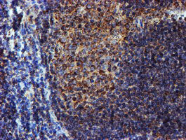 NDUFB9 Antibody - IHC of paraffin-embedded Human tonsil using anti-NDUFB9 mouse monoclonal antibody.