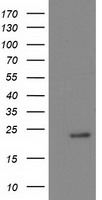 NDUFB9 Antibody - HEK293T cells were transfected with the pCMV6-ENTRY control (Left lane) or pCMV6-ENTRY NDUFB9 (Right lane) cDNA for 48 hrs and lysed. Equivalent amounts of cell lysates (5 ug per lane) were separated by SDS-PAGE and immunoblotted with anti-NDUFB9.