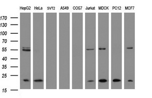 NDUFB9 Antibody - Western blot of extracts (35 ug) from 9 different cell lines by using g anti-NDUFB9 monoclonal antibody (HepG2: human; HeLa: human; SVT2: mouse; A549: human; COS7: monkey; Jurkat: human; MDCK: canine; PC12: rat; MCF7: human).