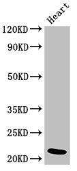 NDUFB9 Antibody - Positive Western Blot detected in Rat heart tissue. All lanes: NDUFB9 antibody at 4 µg/ml Secondary Goat polyclonal to rabbit IgG at 1/50000 dilution. Predicted band size: 22 KDa. Observed band size: 22 KDa
