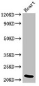 NDUFB9 Antibody - Positive Western Blot detected in Rat heart tissue. All lanes: NDUFB9 antibody at 4 µg/ml Secondary Goat polyclonal to rabbit IgG at 1/50000 dilution. Predicted band size: 22 KDa. Observed band size: 22 KDa