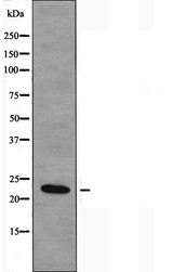 NDUFB9 Antibody - Western blot analysis of extracts of COLO cells using NDUFB9 antibody.