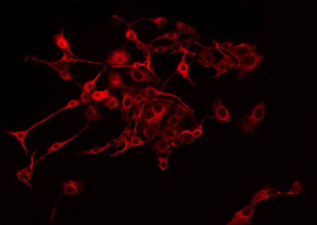 NDUFB9 Antibody - Staining COLO205 cells by IF/ICC. The samples were fixed with PFA and permeabilized in 0.1% Triton X-100, then blocked in 10% serum for 45 min at 25°C. The primary antibody was diluted at 1:200 and incubated with the sample for 1 hour at 37°C. An Alexa Fluor 594 conjugated goat anti-rabbit IgG (H+L) Ab, diluted at 1/600, was used as the secondary antibody.