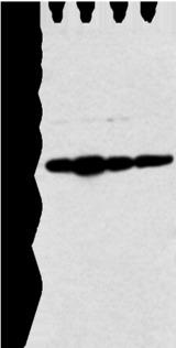 NDUFB9 Antibody - Western blot analysis of Hela cell and human fetal liver tissue A549 and Jurkat cell  using NDUFB9 Polyclonal Antibody at dilution of 1:400