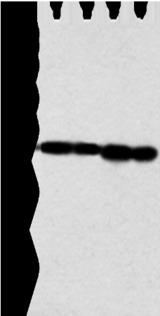 NDUFB9 Antibody - Western blot analysis of Jurkat and A549 cell human fetal liver tissue and hela cell  using NDUFB9 Polyclonal Antibody at dilution of 1:350