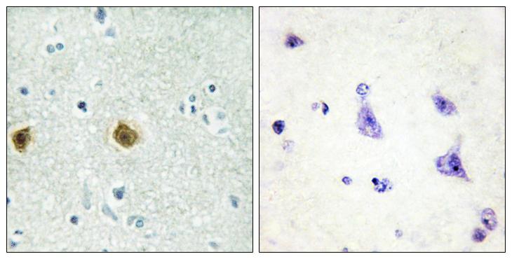 NDUFC2 Antibody - Immunohistochemistry analysis of paraffin-embedded human brain tissue, using NDUC2 Antibody. The picture on the right is blocked with the synthesized peptide.