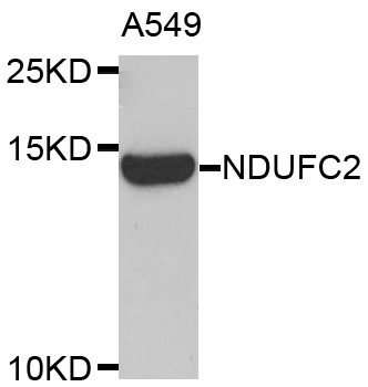 NDUFC2 Antibody - Western blot analysis of extracts of A549 cells.
