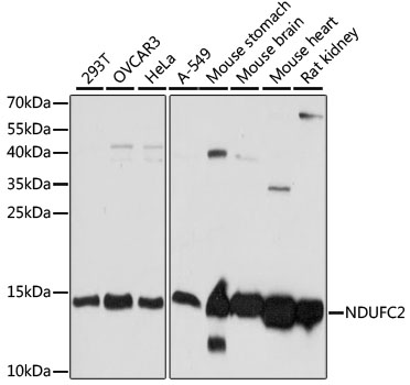 NDUFC2 Antibody - Western blot analysis of extracts of various cell lines, using NDUFC2 antibody at 1:1000 dilution. The secondary antibody used was an HRP Goat Anti-Rabbit IgG (H+L) at 1:10000 dilution. Lysates were loaded 25ug per lane and 3% nonfat dry milk in TBST was used for blocking. An ECL Kit was used for detection and the exposure time was 5s.