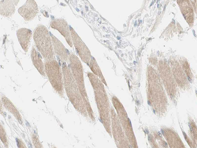 NDUFC2 Antibody - 1:100 staining human skeletal muscle tissue by IHC-P. The tissue was formaldehyde fixed and a heat mediated antigen retrieval step in citrate buffer was performed. The tissue was then blocked and incubated with the antibody for 1.5 hours at 22°C. An HRP conjugated goat anti-rabbit antibody was used as the secondary.