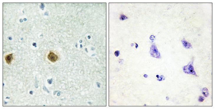 NDUFC2 Antibody - Peptide - + Immunohistochemistry analysis of paraffin-embedded human brain tissue, using NDUC2 antibody.
