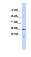 NDUFC2 Antibody - NDUFC2 antibody Western blot of 293T cell lysate. This image was taken for the unconjugated form of this product. Other forms have not been tested.