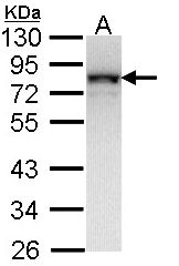 NDUFS1 Antibody - Sample (30 ug of whole cell lysate). A: Molt-4 . 12% SDS PAGE. NDUFS1 antibody diluted at 1:1000.