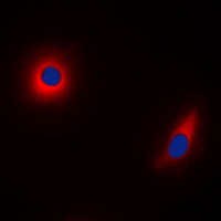 NDUFS1 Antibody - Immunofluorescent analysis of NDUFS1 staining in HeLa cells. Formalin-fixed cells were permeabilized with 0.1% Triton X-100 in TBS for 5-10 minutes and blocked with 3% BSA-PBS for 30 minutes at room temperature. Cells were probed with the primary antibody in 3% BSA-PBS and incubated overnight at 4 C in a humidified chamber. Cells were washed with PBST and incubated with a DyLight 594-conjugated secondary antibody (red) in PBS at room temperature in the dark. DAPI was used to stain the cell nuclei (blue).