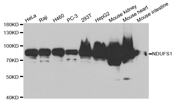 NDUFS1 Antibody - Western blot analysis of extracts of various cell lines.