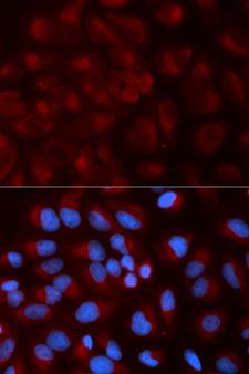NDUFS1 Antibody - Immunofluorescence analysis of U2OS cells.