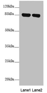 NDUFS1 Antibody - Western blot All Lanes: NDUFS1 antibody at 2.41 ug/ml Lane 1: Mouse heart tissue Lane 2: Mouse kidney tissue Secondary Goat polyclonal to rabbit IgG at 1/10000 dilution Predicted band size: 80,81,68,74,76 kDa Observed band size: 79 kDa