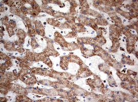 NDUFS2 Antibody - IHC of paraffin-embedded Human liver tissue using anti-NDUFS2 mouse monoclonal antibody. (Heat-induced epitope retrieval by 10mM citric buffer, pH6.0, 120°C for 3min).