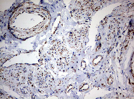 NDUFS2 Antibody - IHC of paraffin-embedded Human endometrium tissue using anti-NDUFS2 mouse monoclonal antibody. (Heat-induced epitope retrieval by 10mM citric buffer, pH6.0, 120°C for 3min).