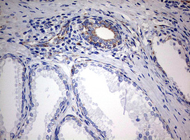 NDUFS2 Antibody - IHC of paraffin-embedded Human prostate tissue using anti-NDUFS2 mouse monoclonal antibody. (Heat-induced epitope retrieval by 10mM citric buffer, pH6.0, 120°C for 3min).