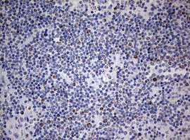 NDUFS2 Antibody - IHC of paraffin-embedded Human lymph node tissue using anti-NDUFS2 mouse monoclonal antibody. (Heat-induced epitope retrieval by 10mM citric buffer, pH6.0, 120°C for 3min).
