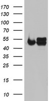 NDUFS2 Antibody - HEK293T cells were transfected with the pCMV6-ENTRY control (Left lane) or pCMV6-ENTRY NDUFS2 (Right lane) cDNA for 48 hrs and lysed. Equivalent amounts of cell lysates (5 ug per lane) were separated by SDS-PAGE and immunoblotted with anti-NDUFS2.