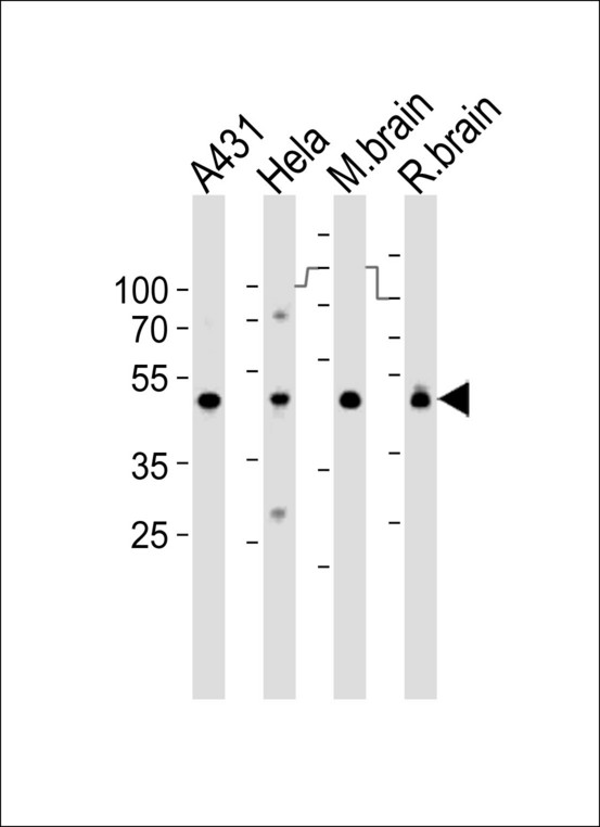 NDUFS2 Antibody - Western blot of lysates from A431, HeLa cell line, mouse brain and rat brain tissue lysate(from left to right), using NDUFS2 Antibody. Antibody was diluted at 1:1000 at each lane. A goat anti-rabbit IgG H&L (HRP) at 1:10000 dilution was used as the secondary antibody. Lysates at 35ug per lane.