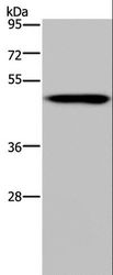 NDUFS2 Antibody - Western blot analysis of Mouse heart tissue, using NDUFS2 Polyclonal Antibody at dilution of 1:250.