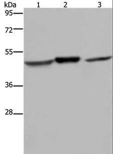 NDUFS2 Antibody - Western blot analysis of Mouse heart and brain tissue, Jurkat cell, using NDUFS2 Polyclonal Antibody at dilution of 1:400.