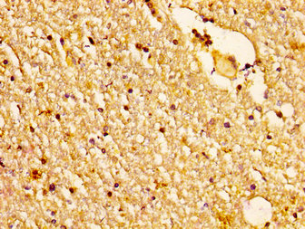 NDUFS2 Antibody - Immunohistochemistry image at a dilution of 1:200 and staining in paraffin-embedded human brain tissue performed on a Leica BondTM system. After dewaxing and hydration, antigen retrieval was mediated by high pressure in a citrate buffer (pH 6.0) . Section was blocked with 10% normal goat serum 30min at RT. Then primary antibody (1% BSA) was incubated at 4 °C overnight. The primary is detected by a biotinylated secondary antibody and visualized using an HRP conjugated SP system.