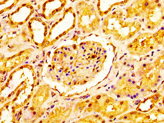 NDUFS2 Antibody - Immunohistochemistry image at a dilution of 1:200 and staining in paraffin-embedded human kidney tissue performed on a Leica BondTM system. After dewaxing and hydration, antigen retrieval was mediated by high pressure in a citrate buffer (pH 6.0) . Section was blocked with 10% normal goat serum 30min at RT. Then primary antibody (1% BSA) was incubated at 4 °C overnight. The primary is detected by a biotinylated secondary antibody and visualized using an HRP conjugated SP system.