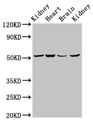 NDUFS2 Antibody - Positive Western Blot detected in Rat kidney tissue, Mouse heart tissue, Mouse brain tissue, Mouse kidney tissue. All lanes: NDUFS2 antibody at 6.9 µg/ml Secondary Goat polyclonal to rabbit IgG at 1/50000 dilution. Predicted band size: 53, 52 KDa. Observed band size: 53 KDa