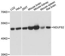 NDUFS2 Antibody - Western blot analysis of extracts of various cell lines, using NDUFS2 antibody at 1:3000 dilution. The secondary antibody used was an HRP Goat Anti-Rabbit IgG (H+L) at 1:10000 dilution. Lysates were loaded 25ug per lane and 3% nonfat dry milk in TBST was used for blocking. An ECL Kit was used for detection and the exposure time was 1s.