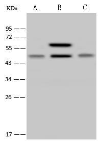 NDUFS2 Antibody - Anti-NDUFS2 rabbit polyclonal antibody at 1:500 dilution. Lane A: HeLa Whole Cell Lysate. Lane B: Jurkat Whole Cell Lysate. Lane C: 293T Whole Cell Lysate. Lysates/proteins at 30 ug per lane. Secondary: Goat Anti-Rabbit IgG (H+L)/HRP at 1/10000 dilution. Developed using the ECL technique. Performed under reducing conditions. Predicted band size: 53 kDa. Observed band size: 50 kDa.