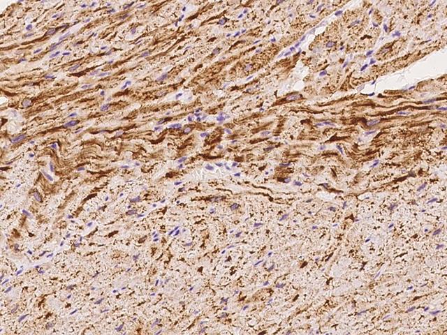 NDUFS2 Antibody - Immunochemical staining of human NDUFS2 in cynomolgus heart with rabbit polyclonal antibody at 1:100 dilution, formalin-fixed paraffin embedded sections.