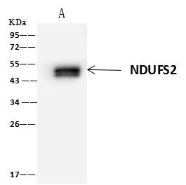 NDUFS2 Antibody - NDUFS2 was immunoprecipitated using: Lane A: 0.5 mg Jurkat Whole Cell Lysate. 4 uL anti-NDUFS2 rabbit polyclonal antibody and 60 ug of Immunomagnetic beads Protein A/G. Primary antibody: Anti-NDUFS2 rabbit polyclonal antibody, at 1:100 dilution. Secondary antibody: Clean-Blot IP Detection Reagent (HRP) at 1:1000 dilution. Developed using the ECL technique. Performed under reducing conditions. Predicted band size: 53 kDa. Observed band size: 45 kDa.