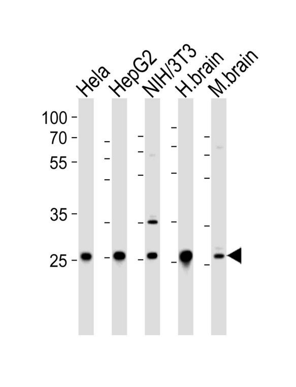 NDUFS3 Antibody - Western blot of lysates from HeLa, HepG2, mouse NIH/3T3 cell line, human brain and mouse brain tissue lysate (from left to right) with NDUFS3 Antibody. Antibody was diluted at 1:1000 at each lane. A goat anti-rabbit IgG H&L (HRP) at 1:5000 dilution was used as the secondary antibody. Lysates at 35 ug per lane.