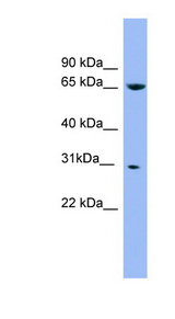 NDUFS3 Antibody - NDUFS3 antibody Western blot of Placenta lysate. This image was taken for the unconjugated form of this product. Other forms have not been tested.